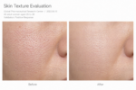NK Serum 30ml
